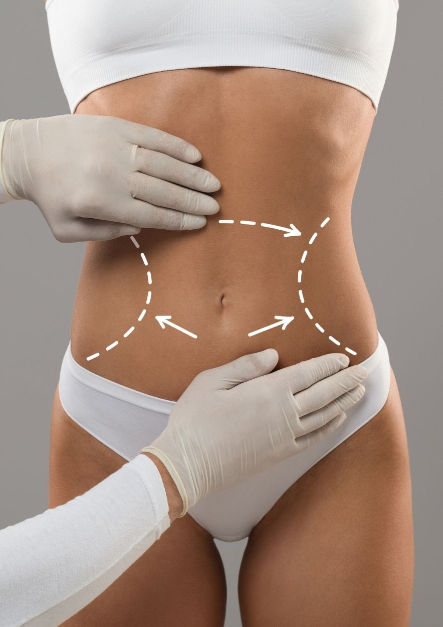 Abdominal & Flank Lipomatic