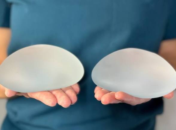 Breast Implants