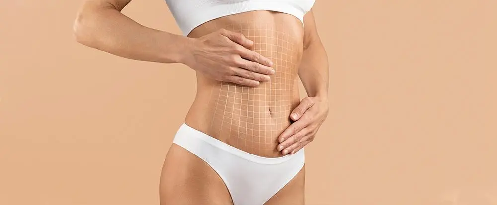 Tummy Tuck