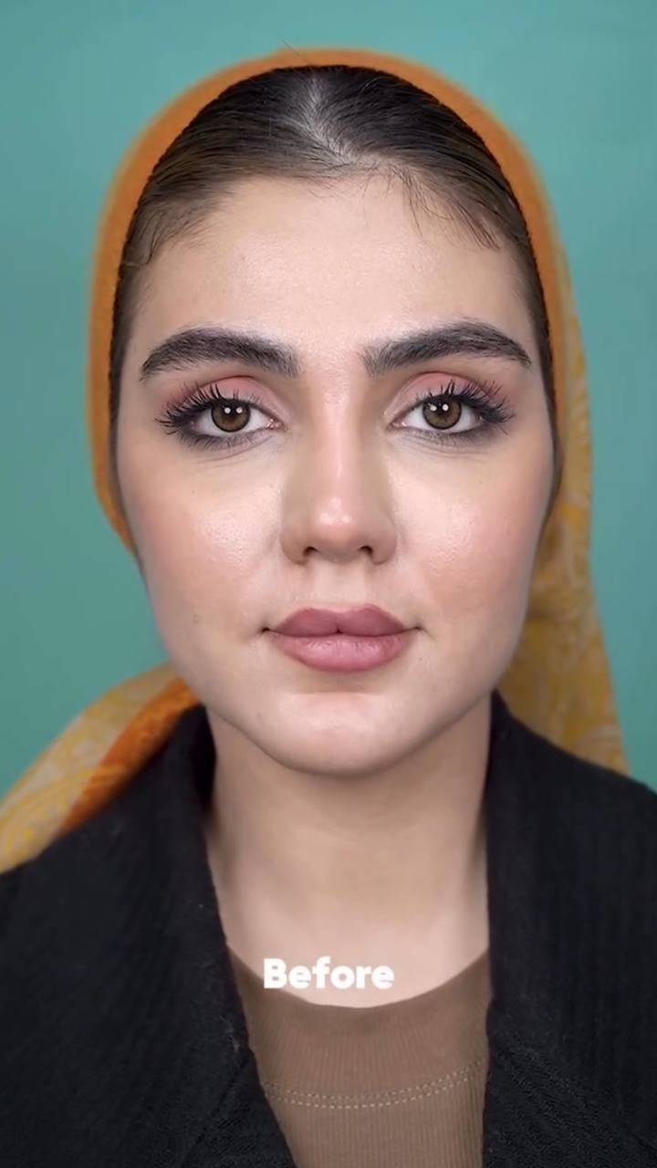 Ameliyat öncesi