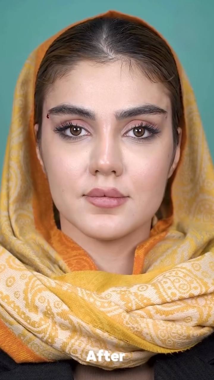 Ameliyat sonrası