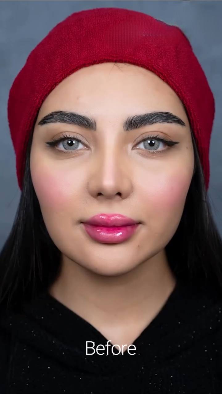 Ameliyat öncesi